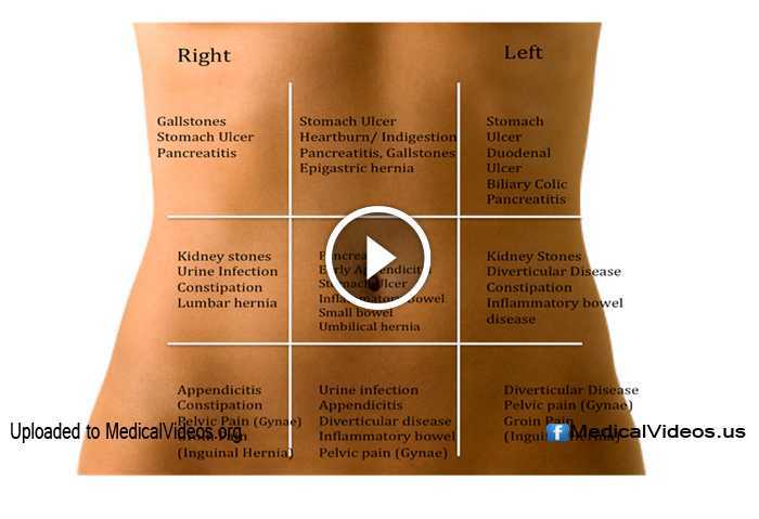 Боль справа отдает. Боль в животе инфографика. Боль внизу живота отдает в заднем проходе. Болит внизу живота у женщин. Болит справа живота у женщины.