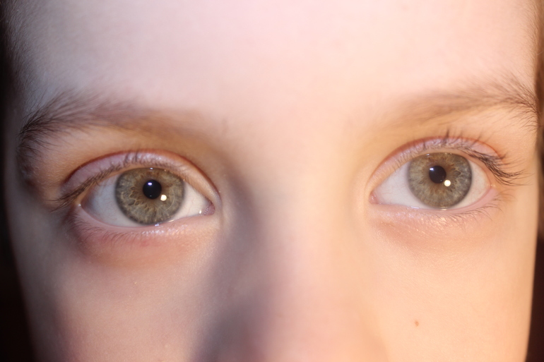 Почему глаза стали голубые. Серо-карие глаза у ребенка. Серо-зелёные глаза у детей. Дети с карими глазами. Изменение цвета глаз у детей.