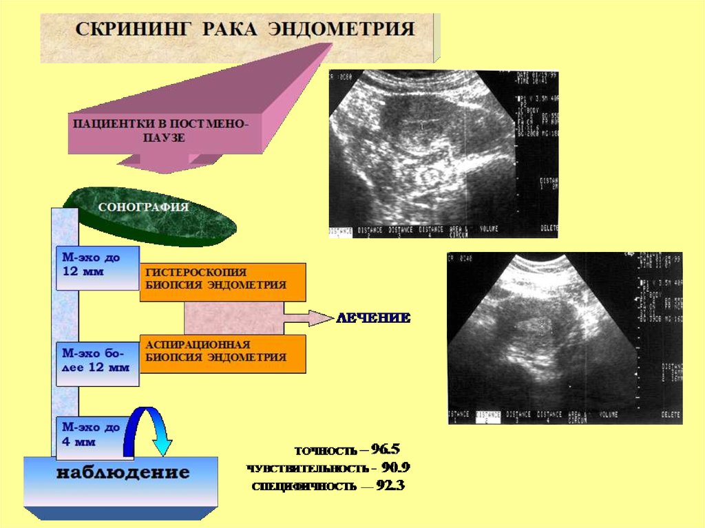 Патологии эндометрии матки. Скрининг гиперплазии эндометрия. Патология эндометрия УЗИ. Методы оценки эндометрия.