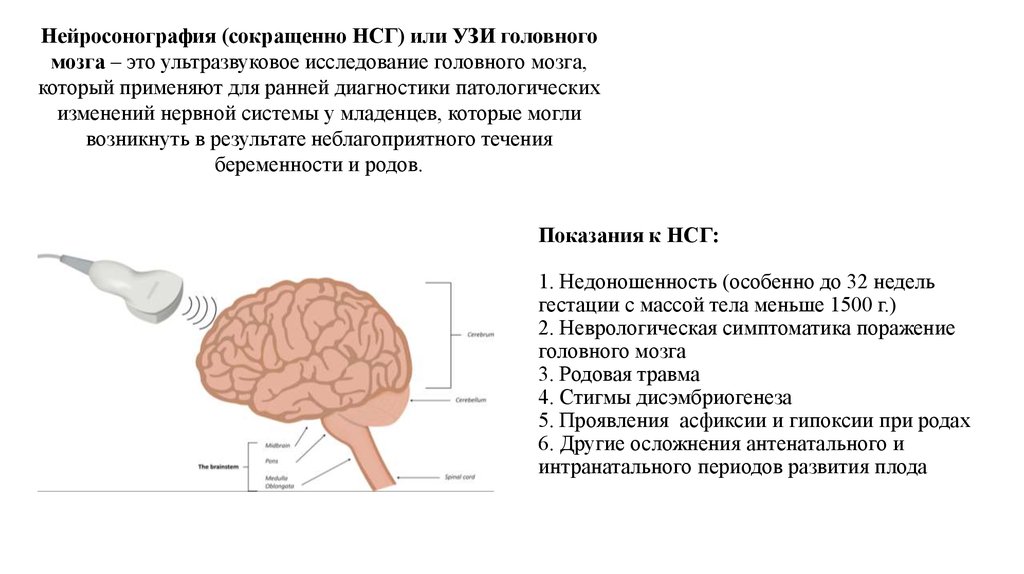 Нсг мозга. Ультразвуковое исследование головного мозга - нейросонография (НСГ). УЗИ анатомия головного мозга новорожденных нейросонография. Нейросонография методика проведения. Нейросонография 4 желудочек.