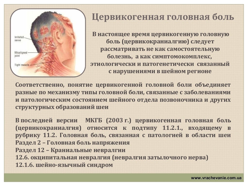 Боли при невралгии. Цервикогенной головной боли. Цервикогенные головные боли. Цервикогенная головная боль симптомы. Боль в затылке.