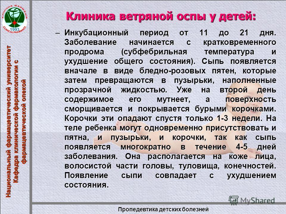 Ветрянка инкубационный период. Ветряная оспа клиника у детей. Инкубационный период ветряной оспы. Инкубационный период при ветряной оспе.