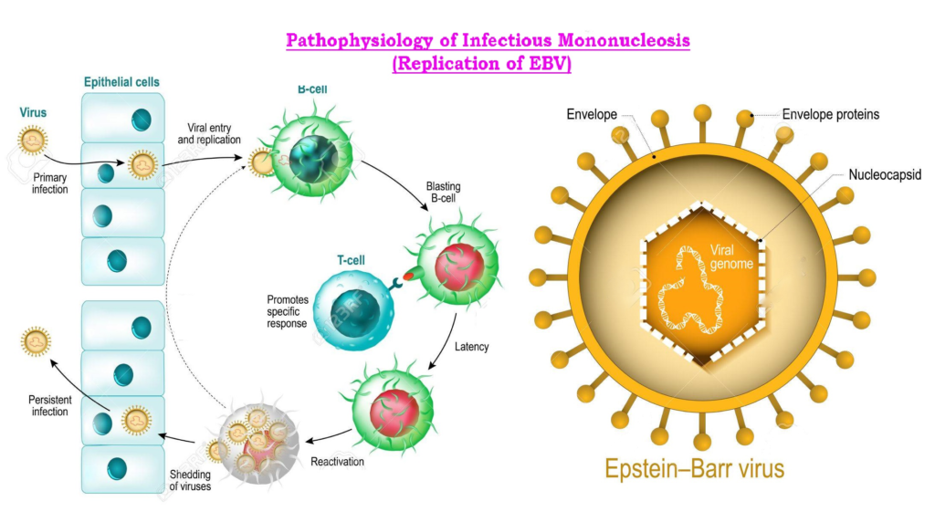 Мононуклеоз вирус эпштейна. Вирус Эпштейна-Барр патогенез. Вирус Эпштейна-Барр этиология.