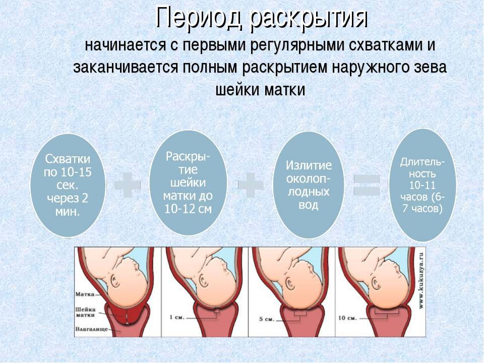 Через сколько после отхождения. Схватка как понять что началось. Предвестниковые схватки ощущения.